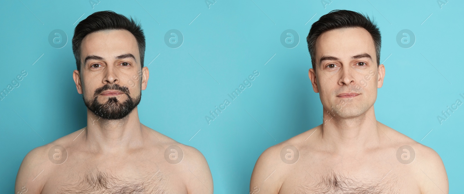 Handsome man before and after shaving on light blue background, collage of photos. Banner design Image of Handsome man before and after shaving on light blue background, collage of photos. Banner design