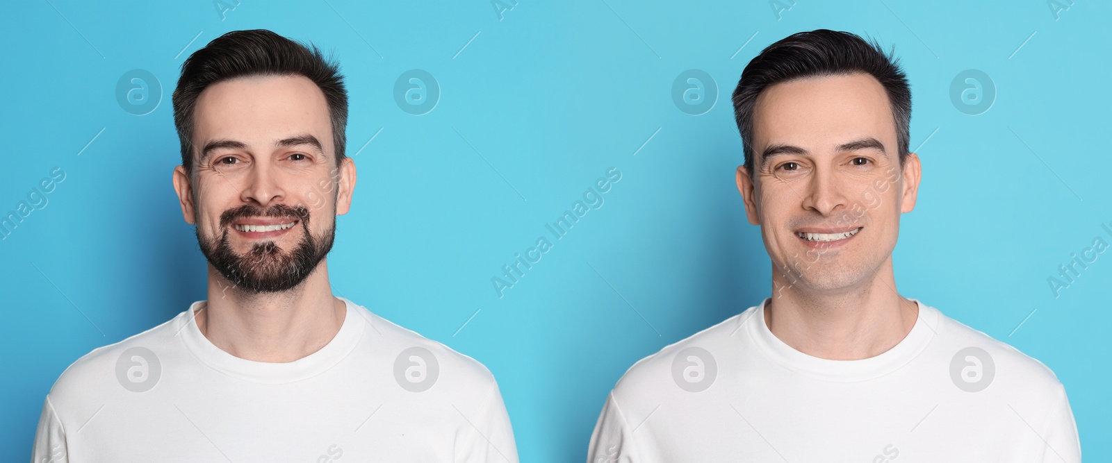 Handsome man before and after shaving on light blue background, collage of photos. Banner design Image of Handsome man before and after shaving on light blue background, collage of photos. Banner design