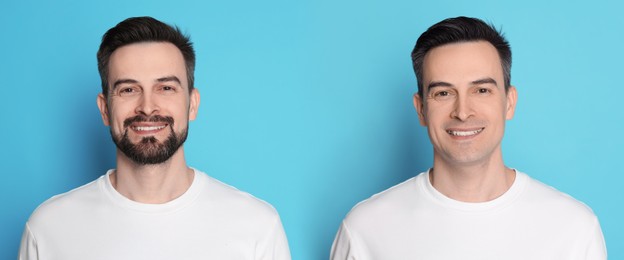 Image of Handsome man before and after shaving on light blue background, collage of photos. Banner design