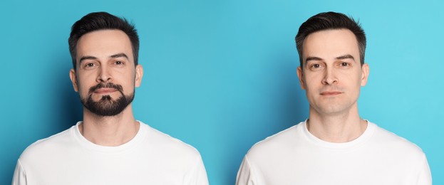Image of Handsome man before and after shaving on light blue background, collage of photos. Banner design