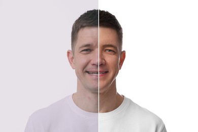 Image of Portrait of man before and after retouching on white background