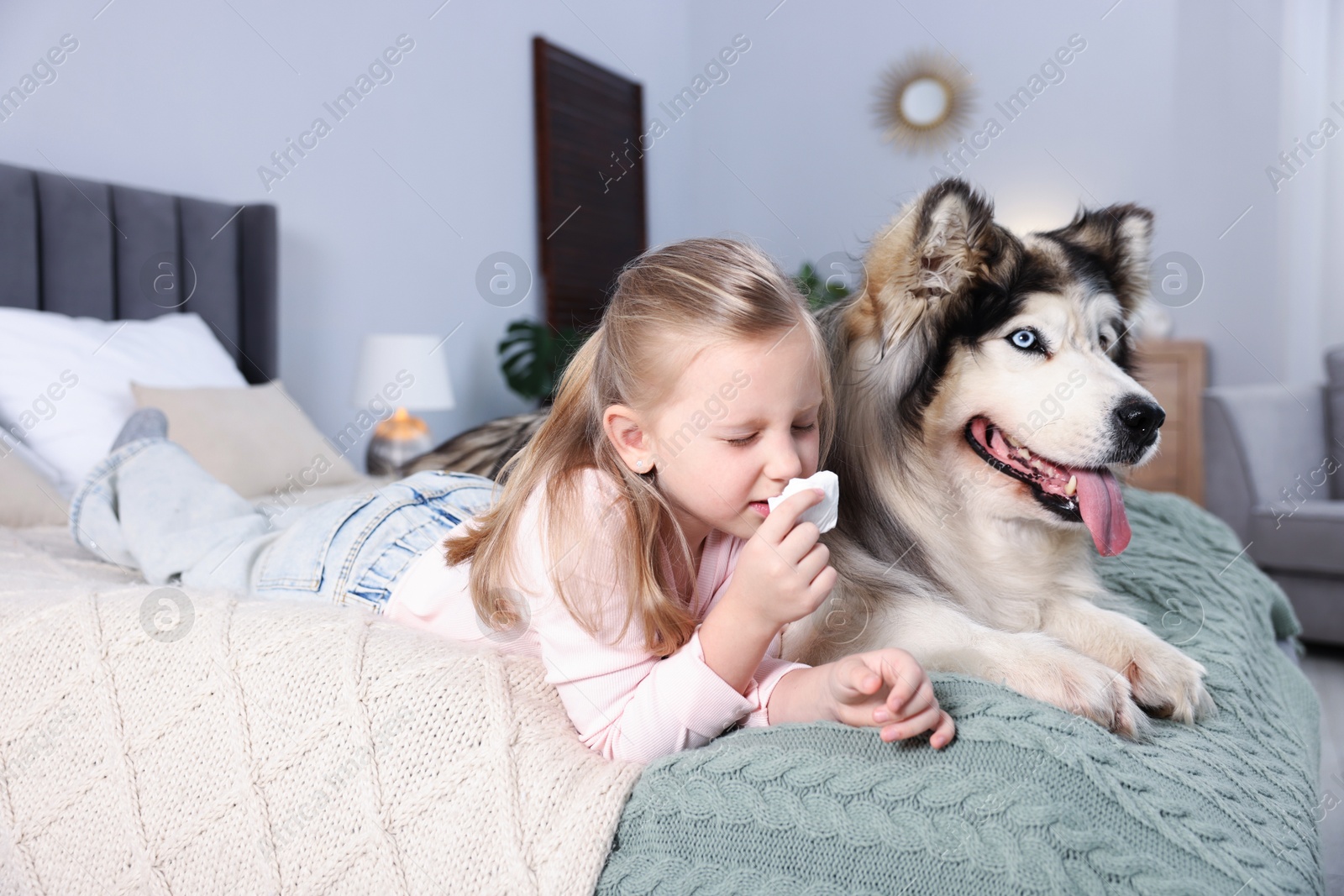 Girl suffering from allergy with her dog on bed at home Photo of Girl suffering from allergy with her dog on bed at home