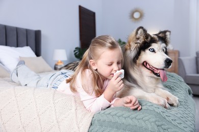 Photo of Girl suffering from allergy with her dog on bed at home
