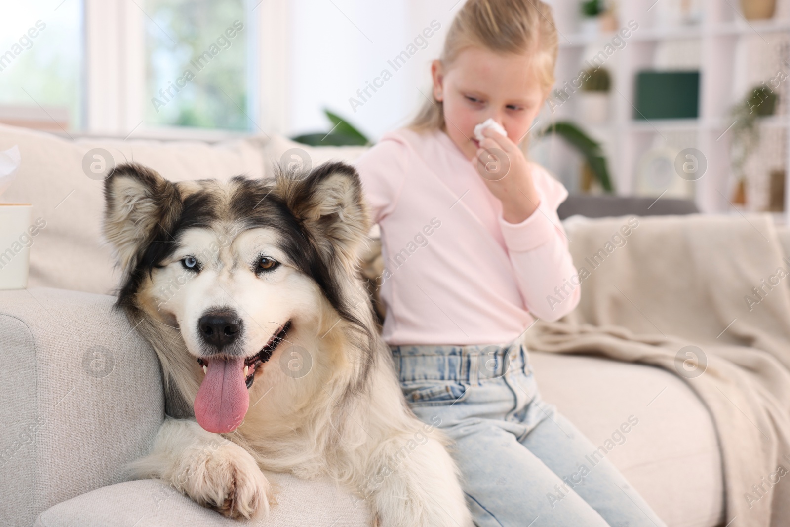 Girl suffering from allergy with her dog at home Photo of Girl suffering from allergy with her dog at home