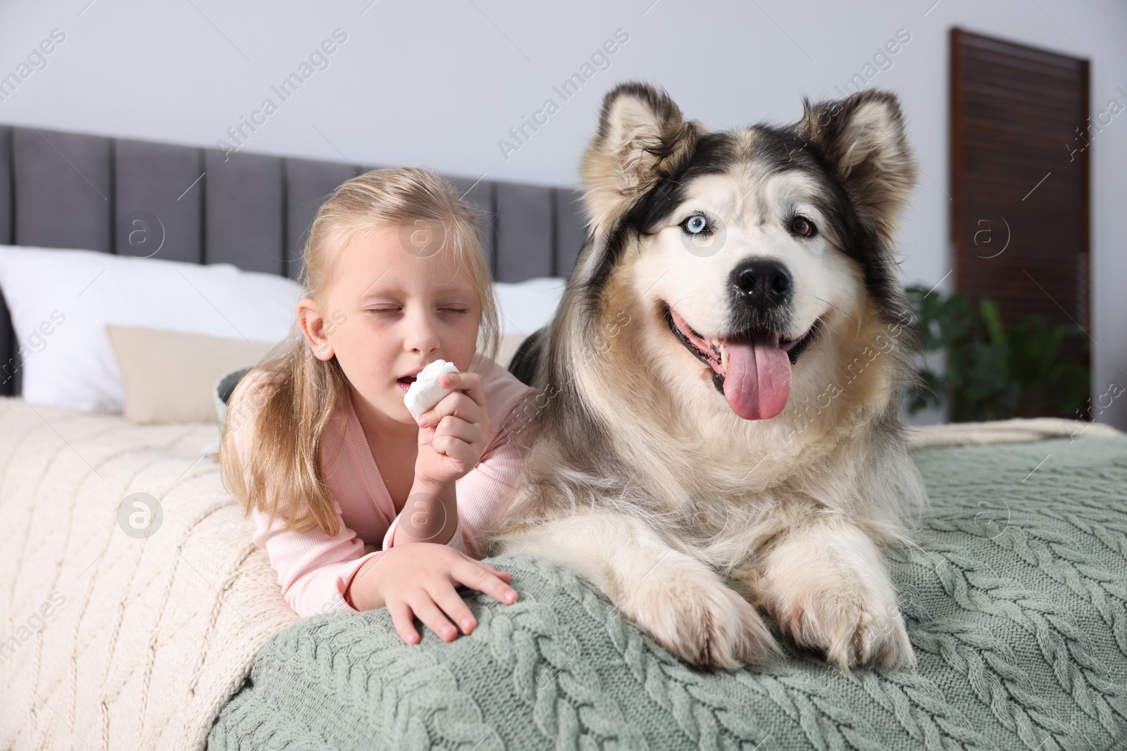 Girl suffering from allergy with her dog on bed at home Photo of Girl suffering from allergy with her dog on bed at home