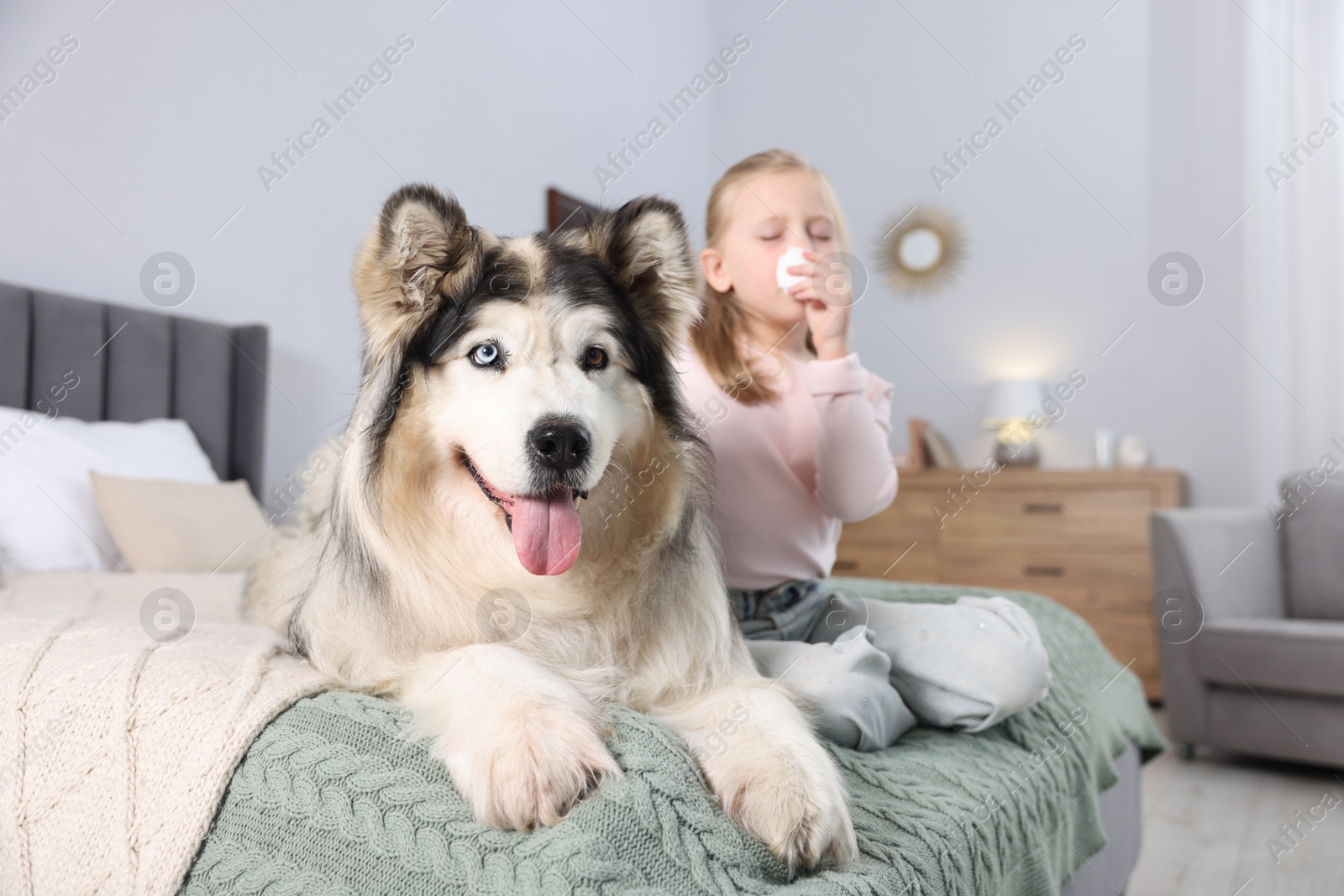 Girl suffering from allergy with her dog on bed at home Photo of Girl suffering from allergy with her dog on bed at home