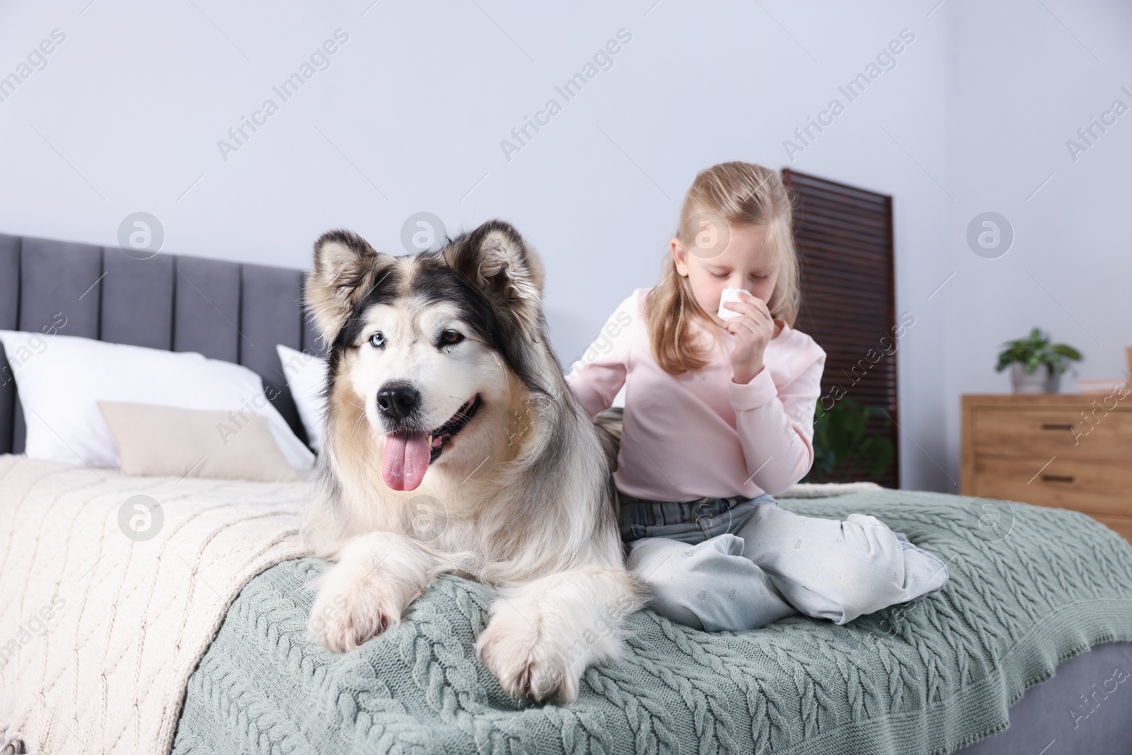 Girl suffering from allergy with her dog on bed at home Photo of Girl suffering from allergy with her dog on bed at home