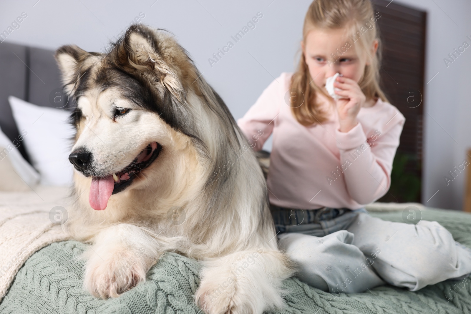 Girl suffering from allergy with her dog on bed at home Photo of Girl suffering from allergy with her dog on bed at home