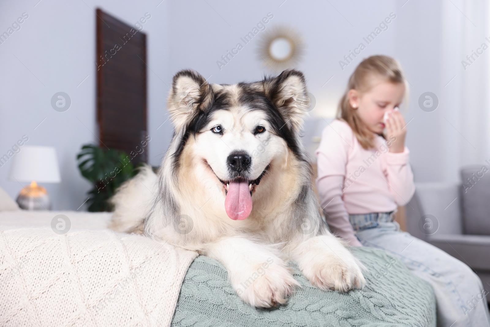 Girl suffering from allergy with her dog on bed at home, selective focus Photo of Girl suffering from allergy with her dog on bed at home, selective focus