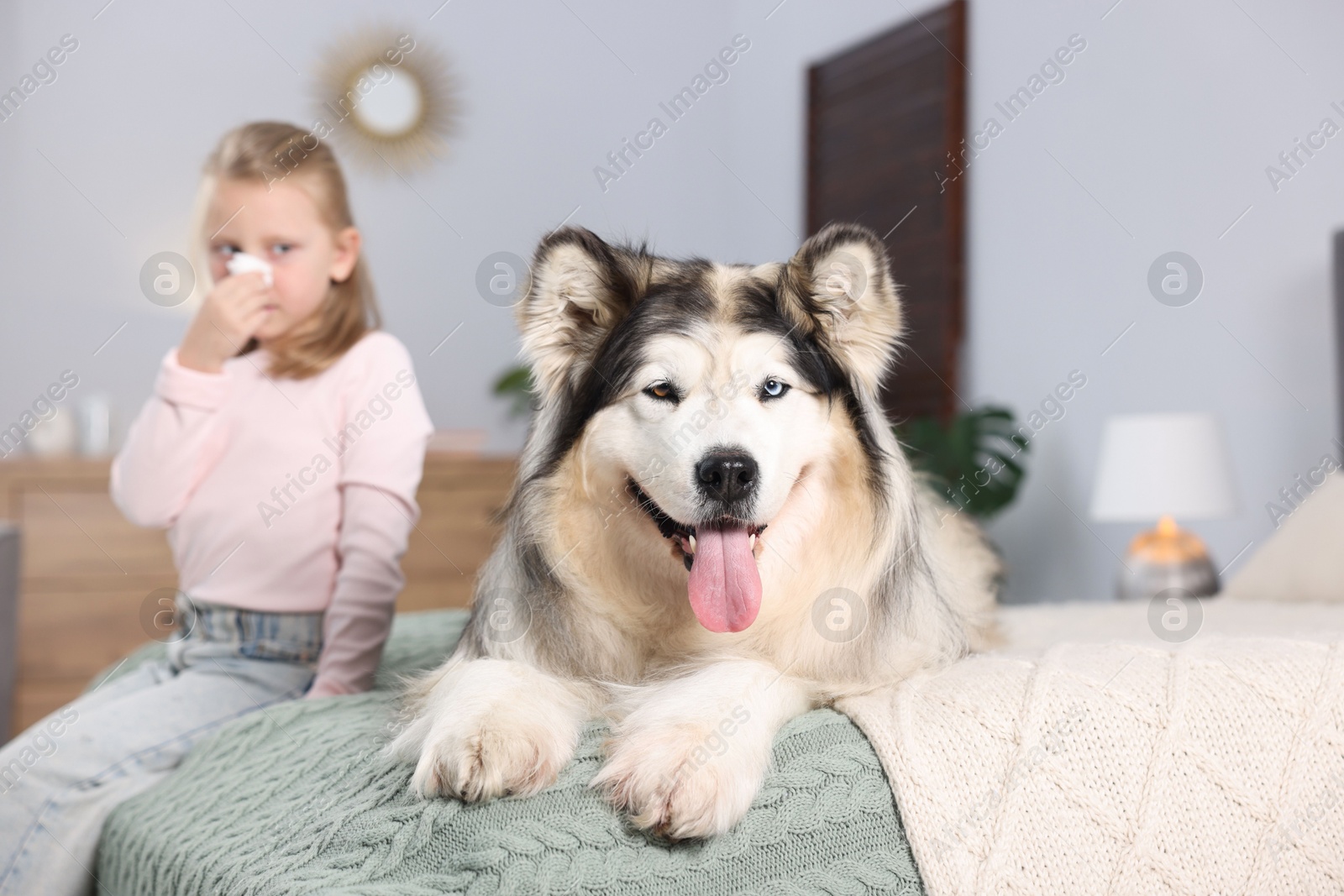Girl suffering from allergy with her dog on bed at home, selective focus Photo of Girl suffering from allergy with her dog on bed at home, selective focus