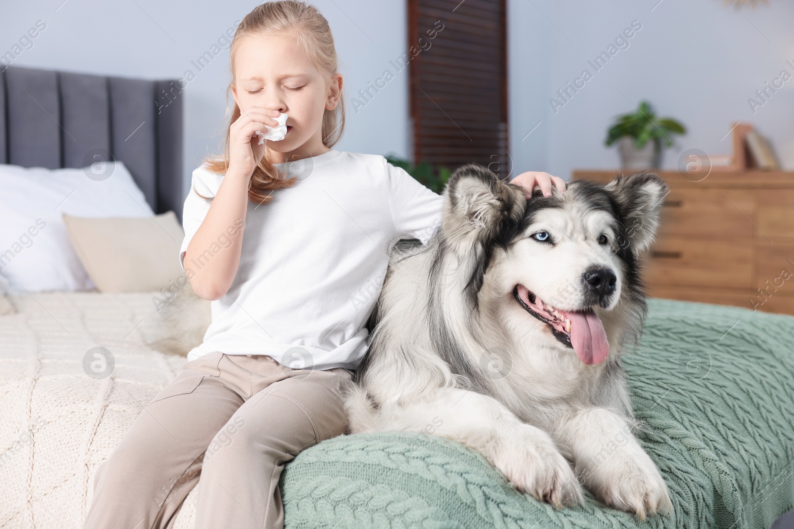 Girl suffering from allergy with her dog on bed at home Photo of Girl suffering from allergy with her dog on bed at home