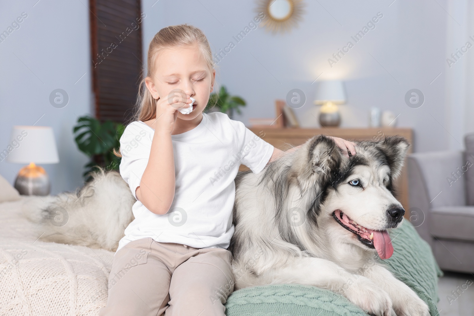 Girl suffering from allergy with her dog on bed at home Photo of Girl suffering from allergy with her dog on bed at home
