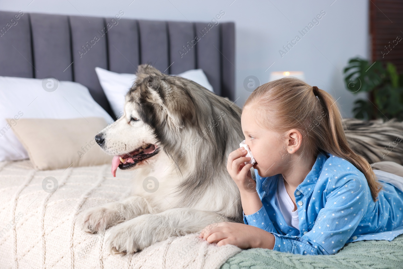 Girl suffering from allergy with her dog on bed at home Photo of Girl suffering from allergy with her dog on bed at home