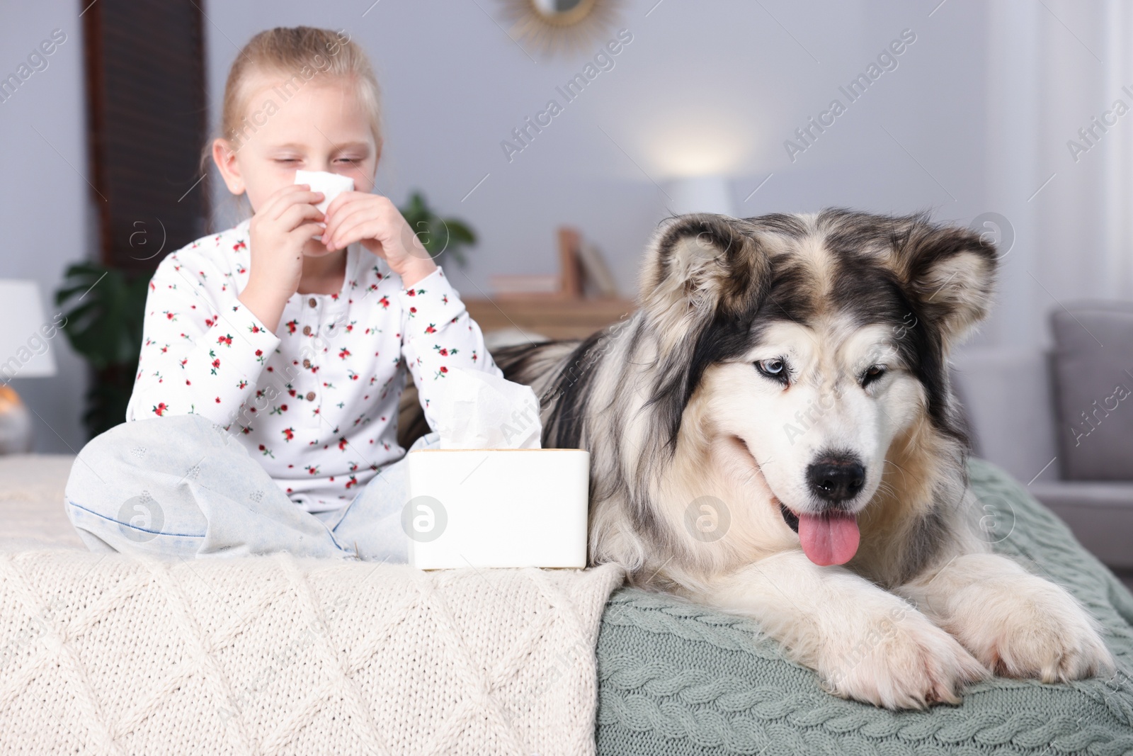Girl suffering from allergy with her dog on bed at home Photo of Girl suffering from allergy with her dog on bed at home