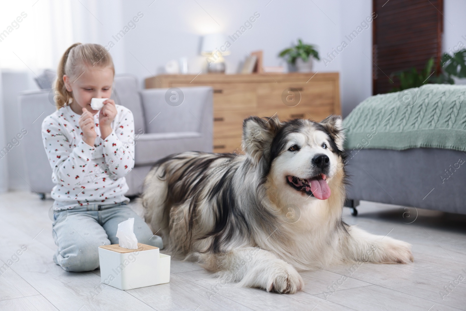 Girl suffering from allergy with her dog at home Photo of Girl suffering from allergy with her dog at home