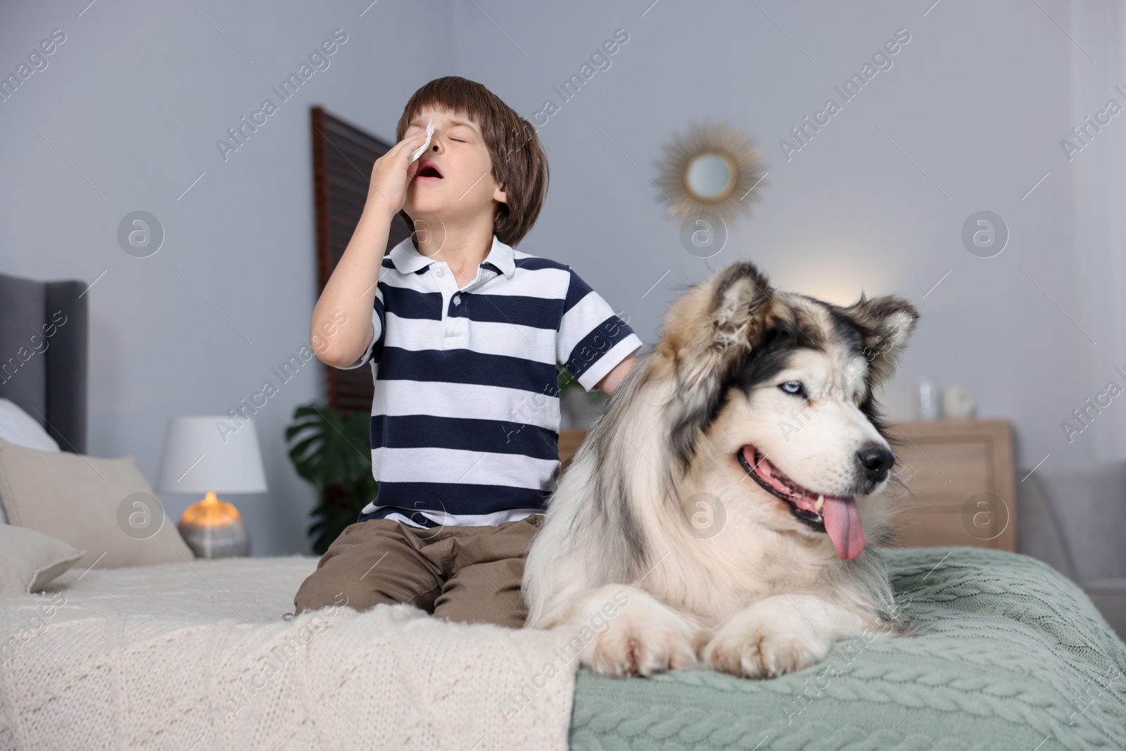 Boy suffering from allergy with her dog on bed at home Photo of Boy suffering from allergy with her dog on bed at home