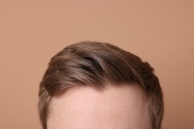 Photo of Man after hair loss treatment on beige background, closeup
