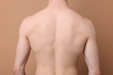 Photo of Man after scoliosis treatment on beige background, back view