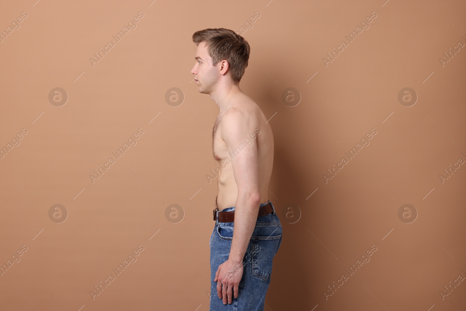 Man before scoliosis treatment on beige background Photo of Man before scoliosis treatment on beige background
