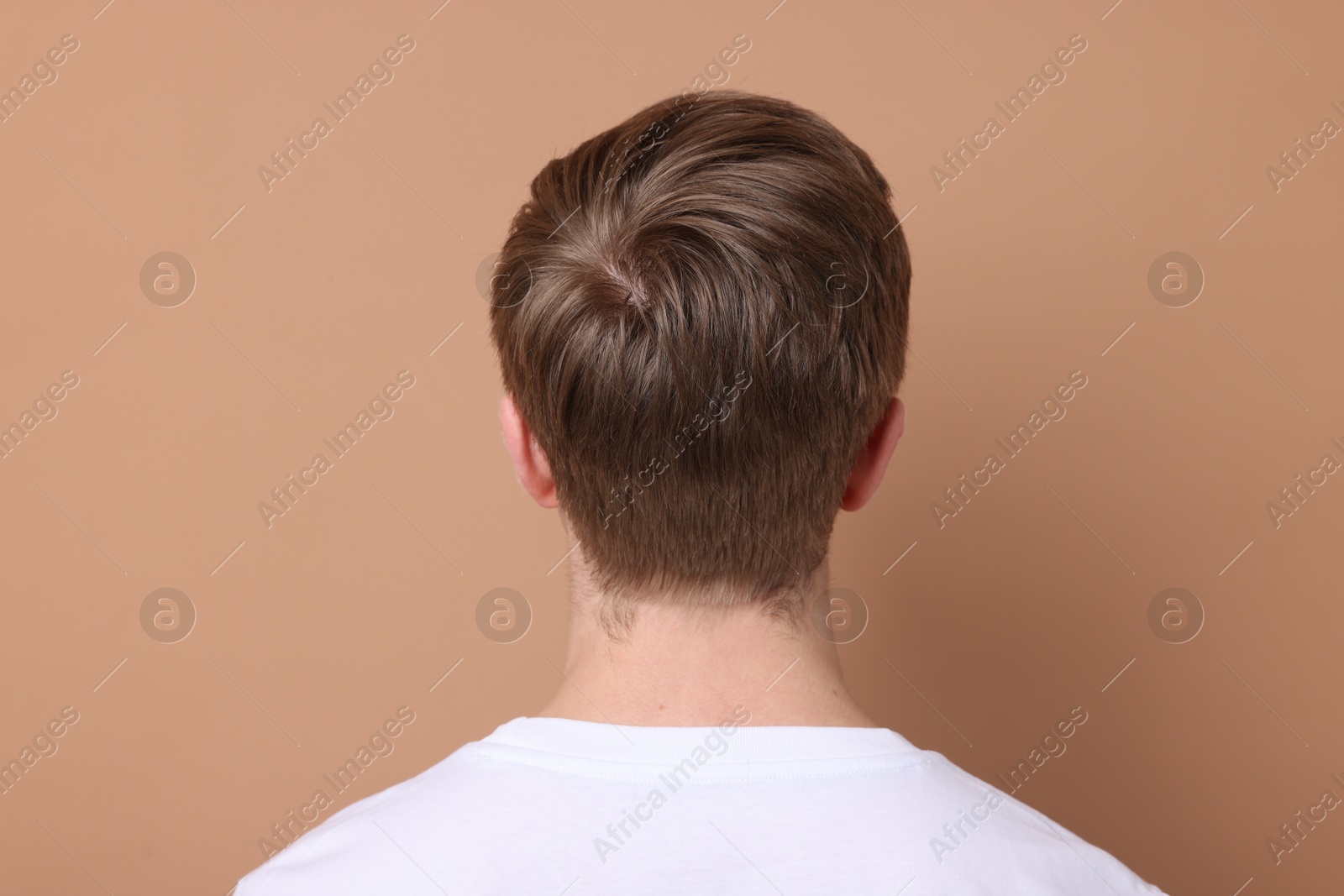 Man after hair loss treatment on beige background, back view Photo of Man after hair loss treatment on beige background, back view