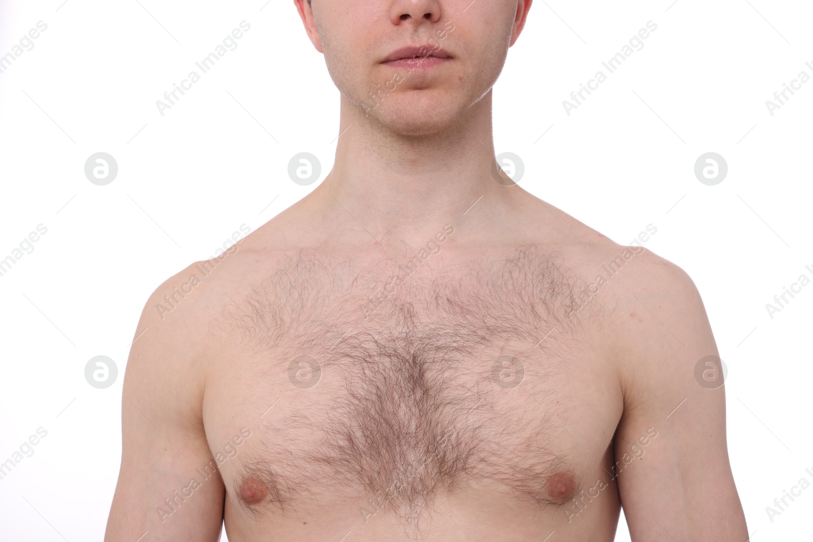 Man before hair removal procedure on white background, closeup Photo of Man before hair removal procedure on white background, closeup