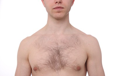 Photo of Man before hair removal procedure on white background, closeup