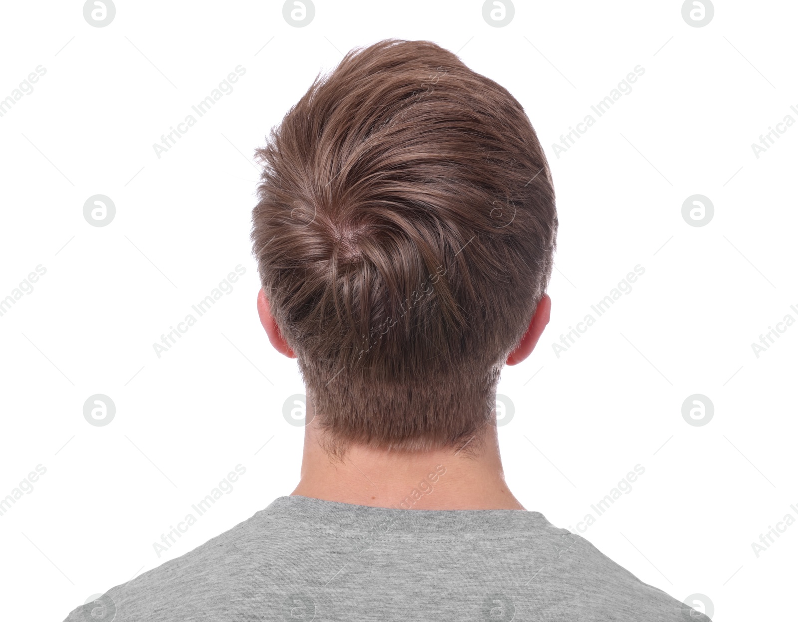 Man after hair loss treatment on white background, back view Photo of Man after hair loss treatment on white background, back view