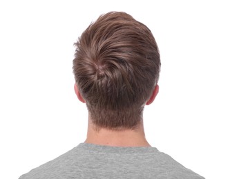 Photo of Man after hair loss treatment on white background, back view
