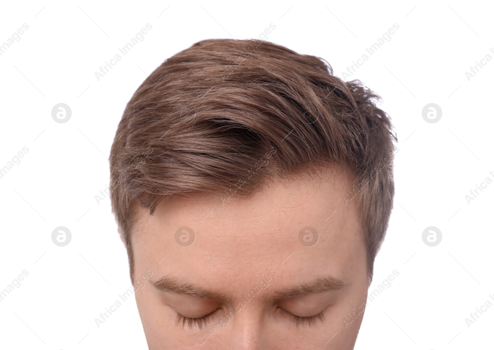 Man after hair loss treatment on white background, closeup Photo of Man after hair loss treatment on white background, closeup