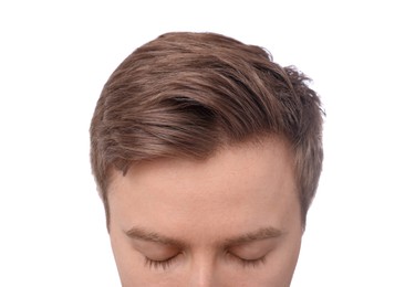 Photo of Man after hair loss treatment on white background, closeup
