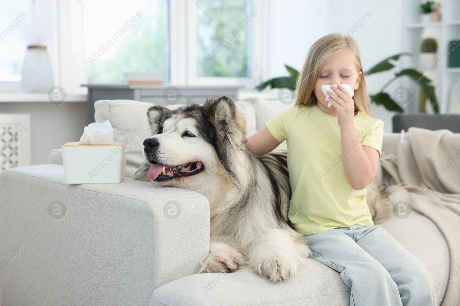 Girl suffering from allergy with her dog at home Photo of Girl suffering from allergy with her dog at home