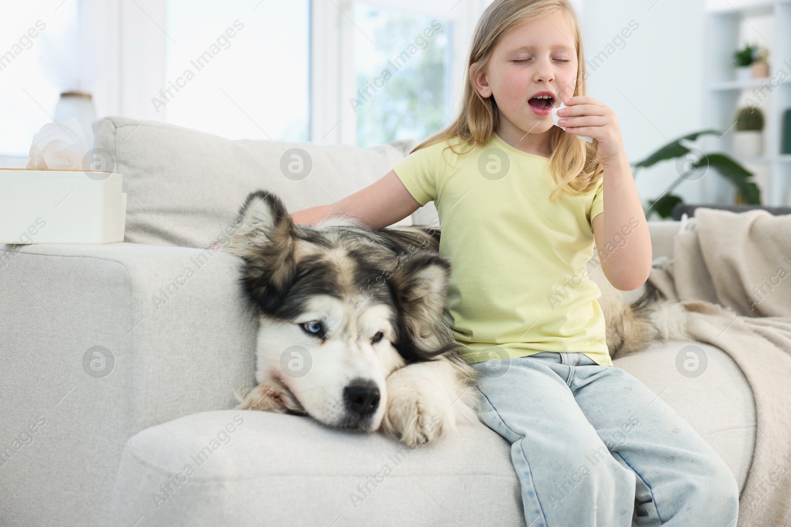 Girl suffering from allergy with her dog at home Photo of Girl suffering from allergy with her dog at home