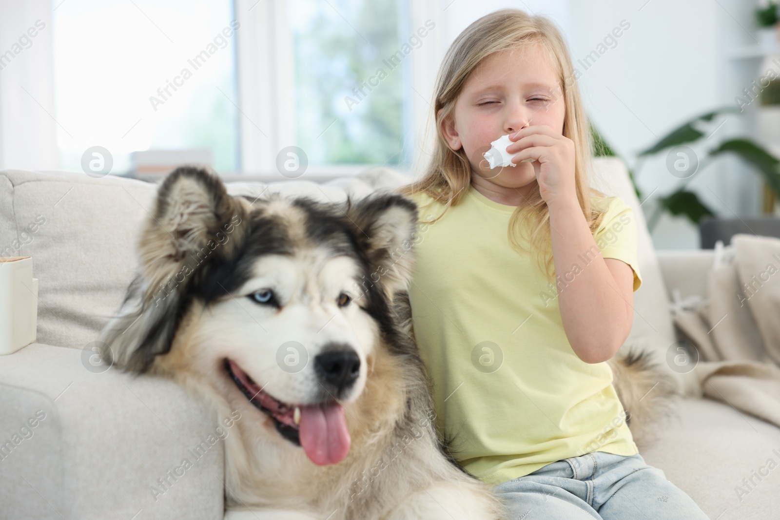Girl suffering from allergy with her dog at home Photo of Girl suffering from allergy with her dog at home