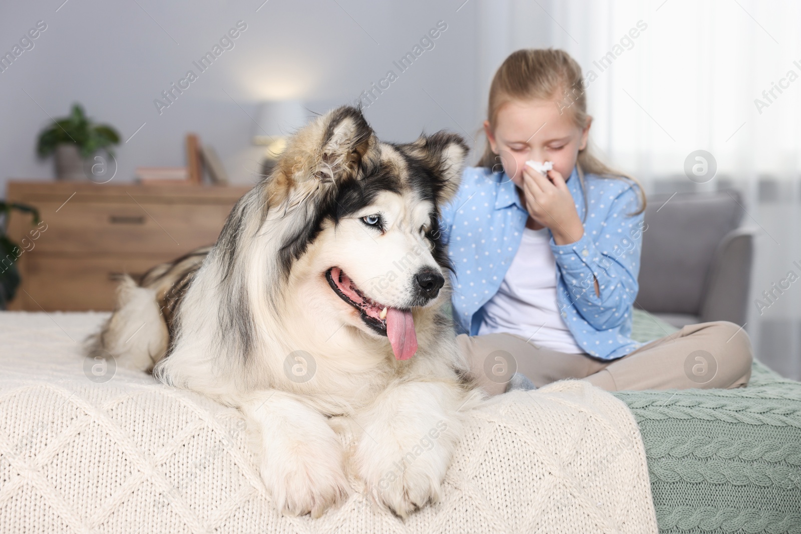 Photo of Girl suffering from allergy with her dog on bed at home