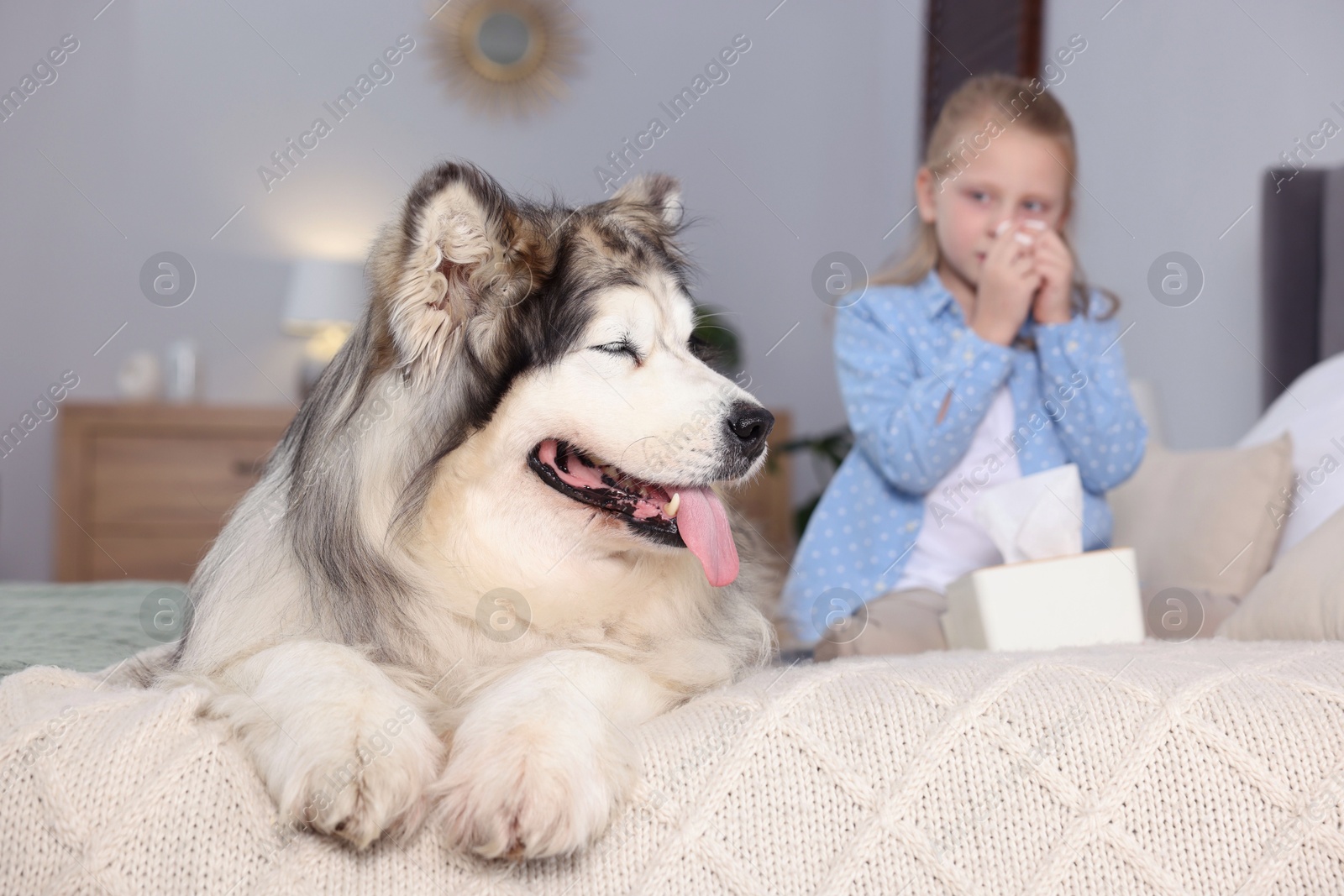 Photo of Girl suffering from allergy with her dog on bed at home, selective focus