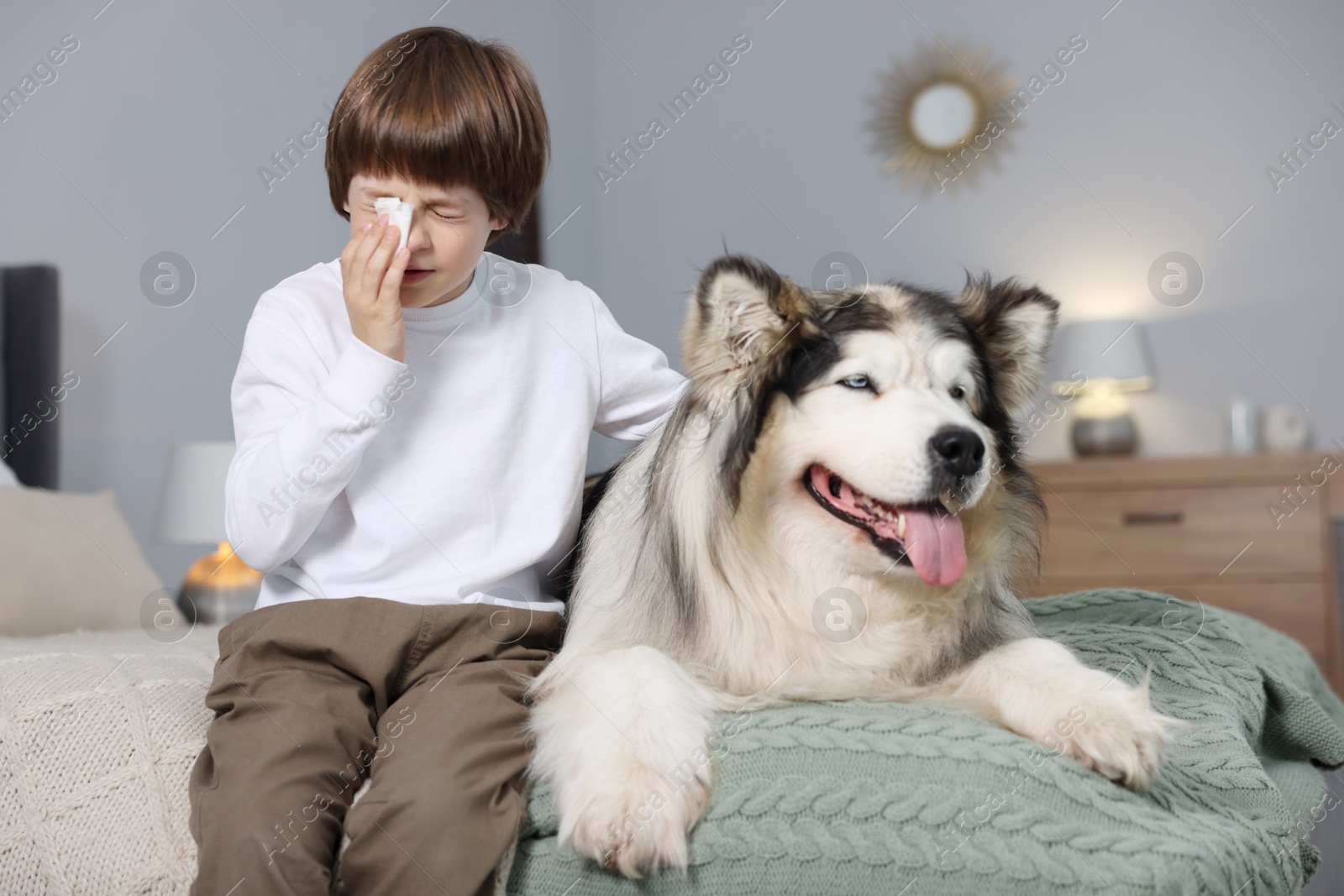 Boy suffering from allergy with her dog on bed at home Photo of Boy suffering from allergy with her dog on bed at home