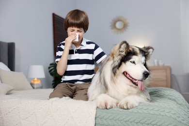 Photo of Boy suffering from allergy with her dog on bed at home