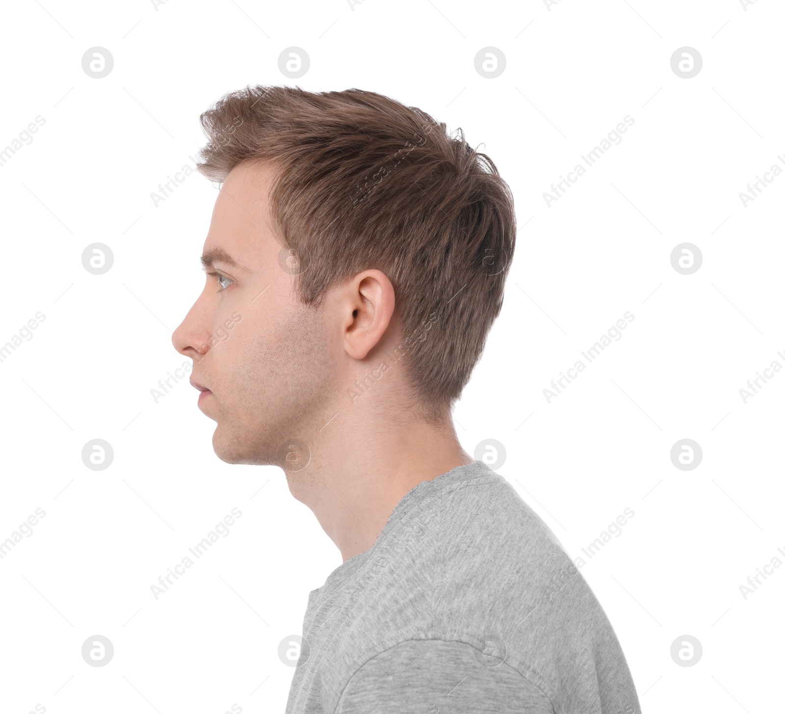 Man before scoliosis treatment on white background Photo of Man before scoliosis treatment on white background
