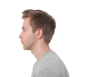 Photo of Man before scoliosis treatment on white background