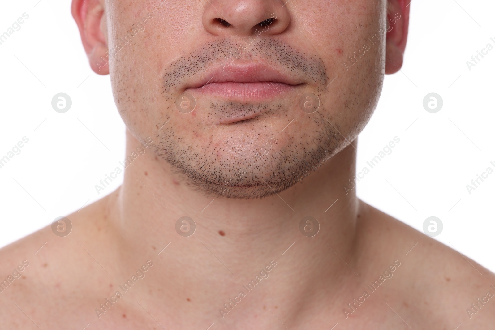 Photo of Closeup view of man on white background