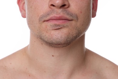 Photo of Closeup view of man on white background
