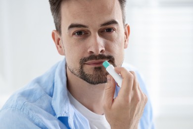 Photo of Handsome man applying lip balm onto his lips on blurred light background