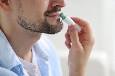 Photo of Man applying lip balm onto his lips on blurred light background, closeup