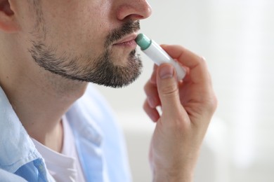 Photo of Man applying lip balm onto his lips on blurred light background, closeup