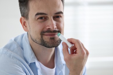 Photo of Handsome man applying lip balm onto his lips on blurred light background