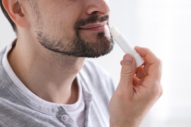 Photo of Man applying lip balm onto his lips on blurred light background, closeup