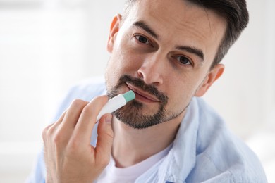 Photo of Handsome man applying lip balm onto his lips on blurred light background