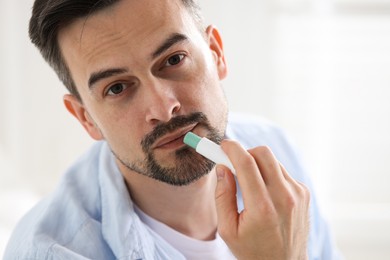 Photo of Handsome man applying lip balm onto his lips on blurred light background