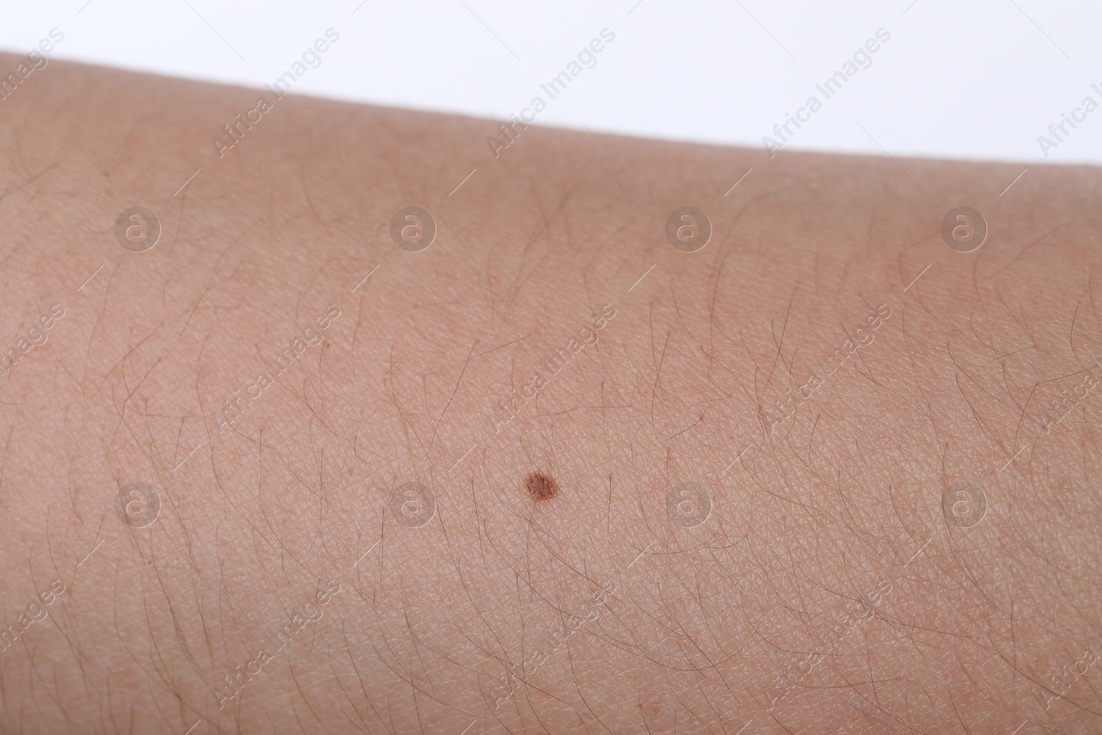 Woman with mole on her body against white background, closeup Photo of Woman with mole on her body against white background, closeup