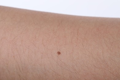 Photo of Woman with mole on her body against white background, closeup